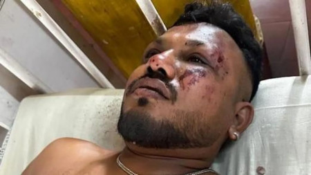 भारतको जहाज दुर्घटनामा ११ए सिटका यात्रु बाँचेको पुष्टि, भने– उडेको ३० सेकेन्डमै जहाज खस्यो