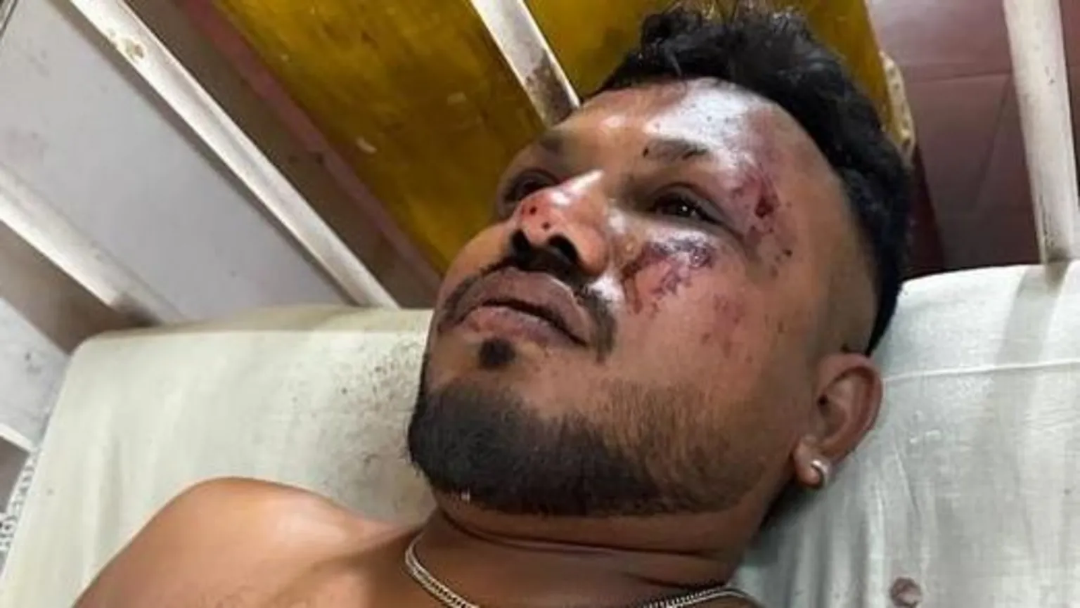 जहाज दुर्घटनामा बाँचेका बेलायती नागरिक विश्वासकुमार रमेश। तस्बिर स्रोत: हिन्दुस्तान टाइम्स